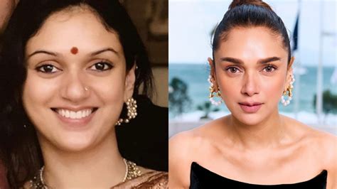 aditi rao hydari before surgery